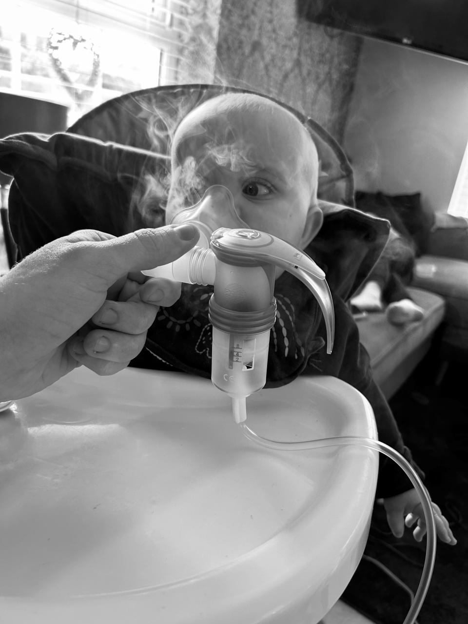 Koa doing inhaled therapies