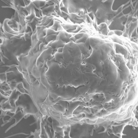 Scanning electron micrograph image of a macrophage eating mycobacteria