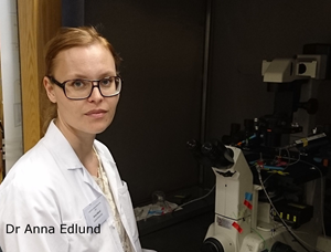 Dr Edlund CFRD