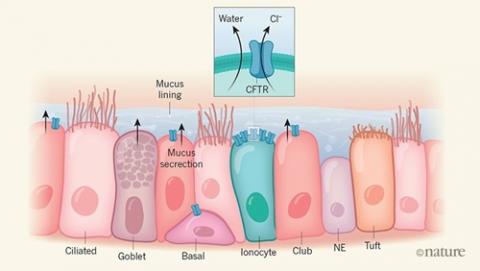 An image of the cells in the linings of the lungs. The different cells are labeled 'cilliated', 'goblet', 'basal', 'Ionocyte', 'club', 'NE' and 'tuft'. There are arrows to show how these cells secrete mucus into the mucus lining. There is also a small diagram of the CFTR channel letting out chloride and water.