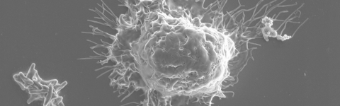 Macrophage and mycobacteria