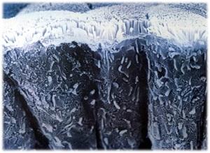 SEM image of three absorptive intestinal cells